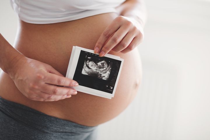 Беременная со снимком УЗИ